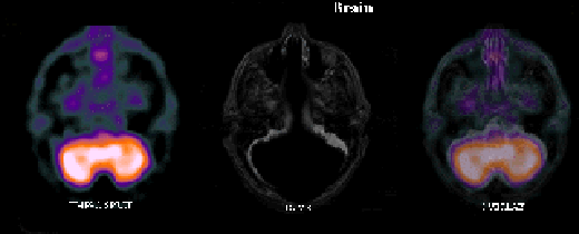 CT-scan2